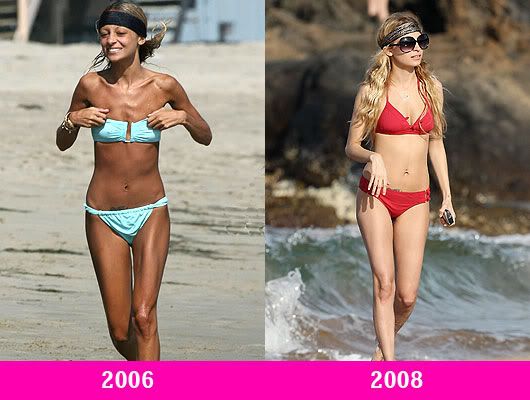 nicole richie weight loss. Nicole Richie Weight Loss. As we said before, not all weight gain is 
